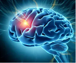 Removing Some Confusion Around Intuition